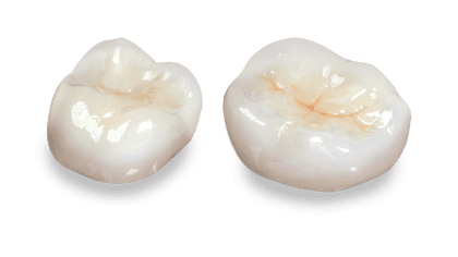 Lava Crowns and Bridges